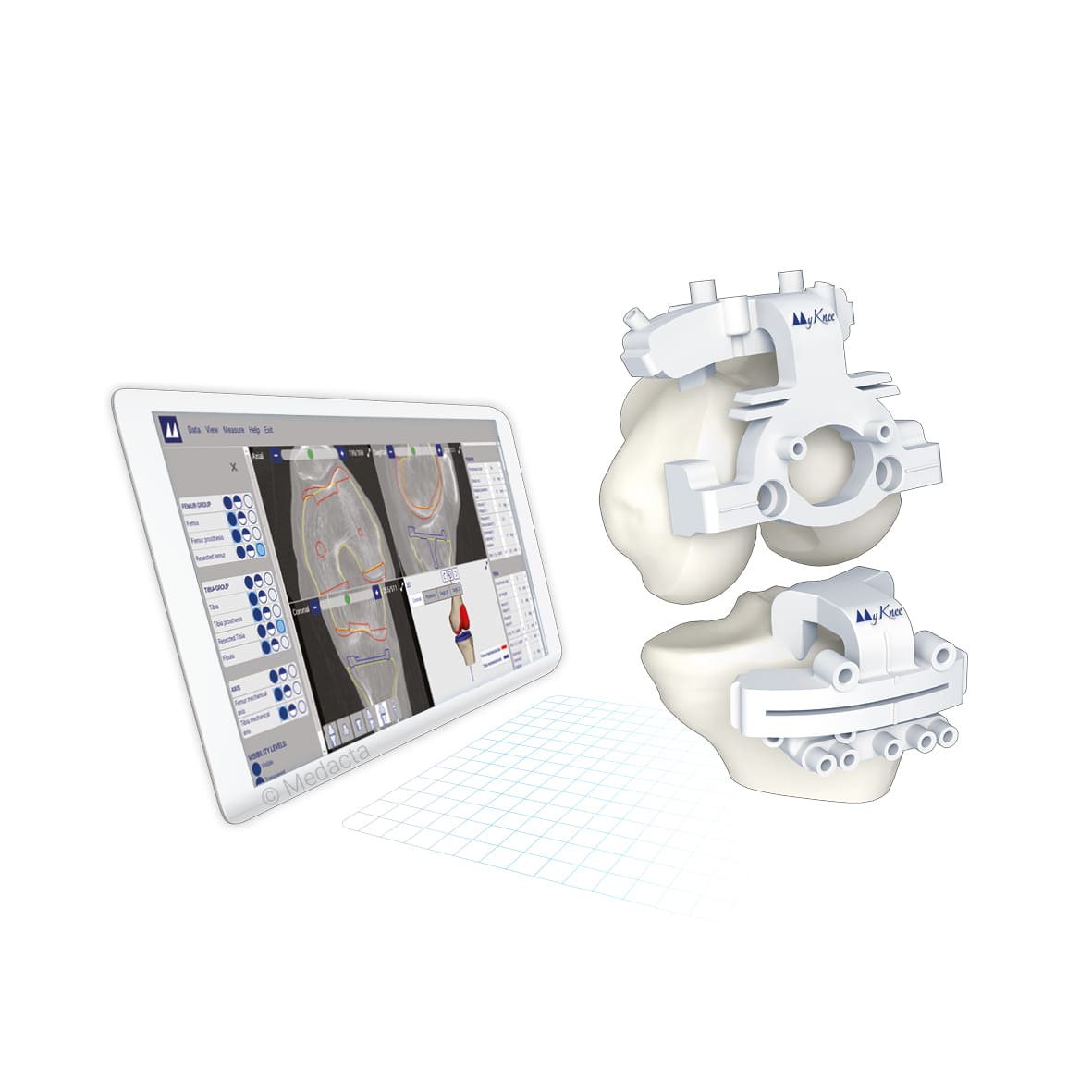 Guides de coupe MyKnee