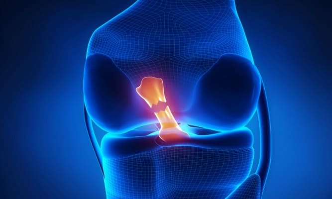 Ligament croisé antérieur